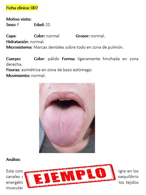 Diagnostico lengua